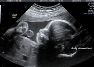 Ultrason baby : 5 569 images, photos de stock, objets 3D et images  vectorielles
