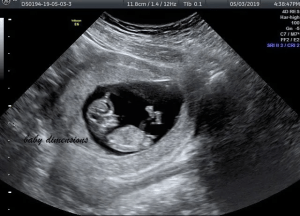 Ultrason baby : 5 569 images, photos de stock, objets 3D et images  vectorielles