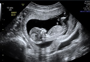 pregnant boy ultrasound