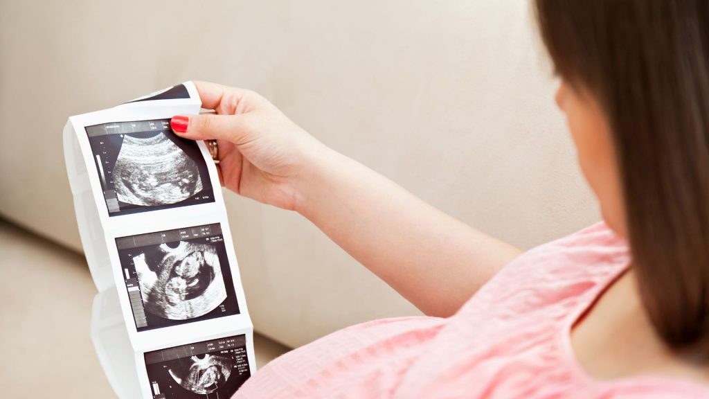 What Exactly Is an Ultrasound, and How Does It Work?