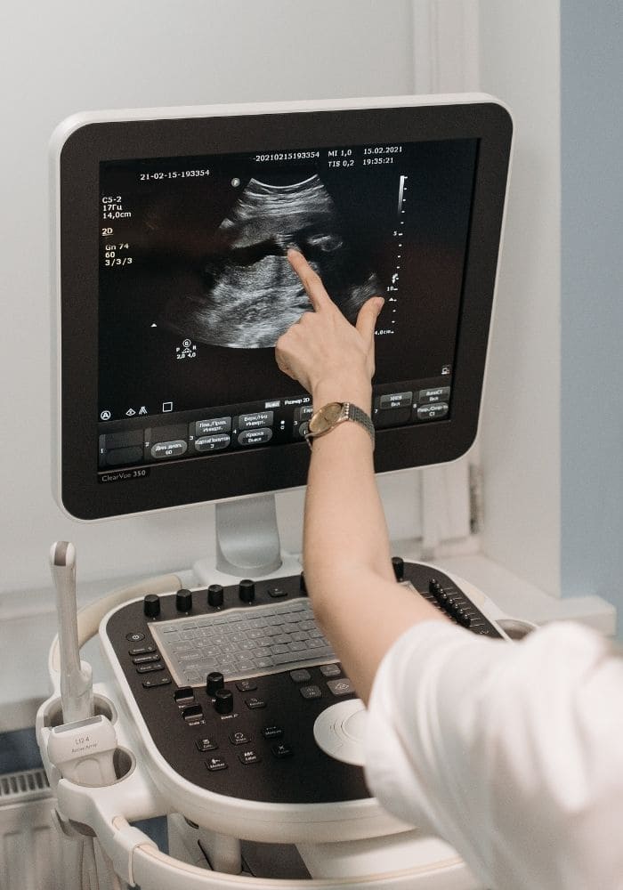 Doctor Showing Ultrasound Results of A Pregnant Woman
