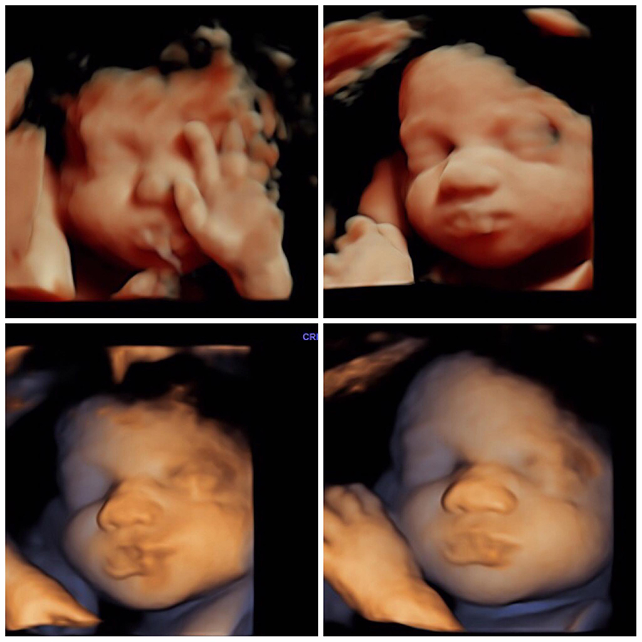 Baby is Making Faces